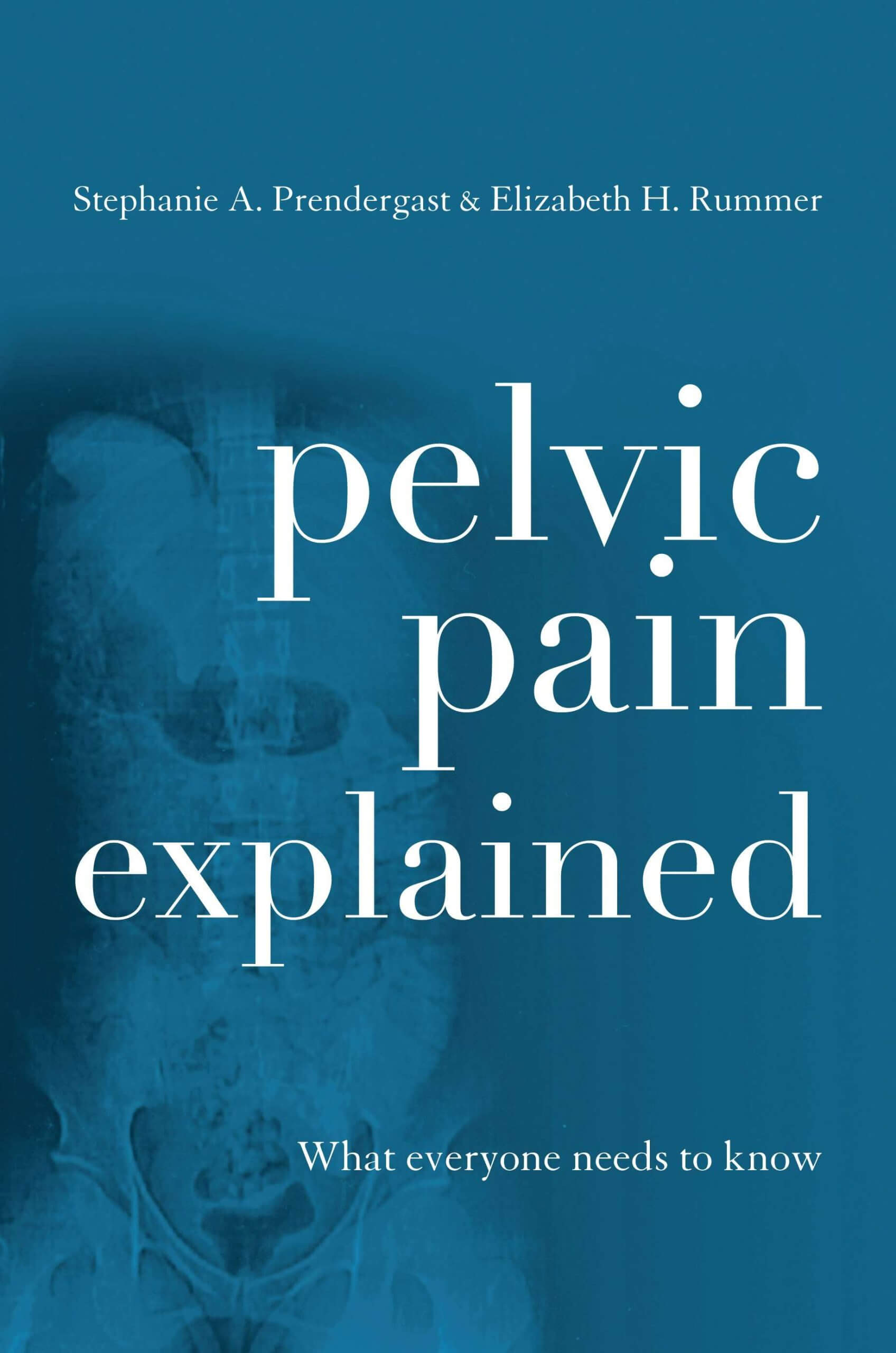 PelvicPainExplainedBook
